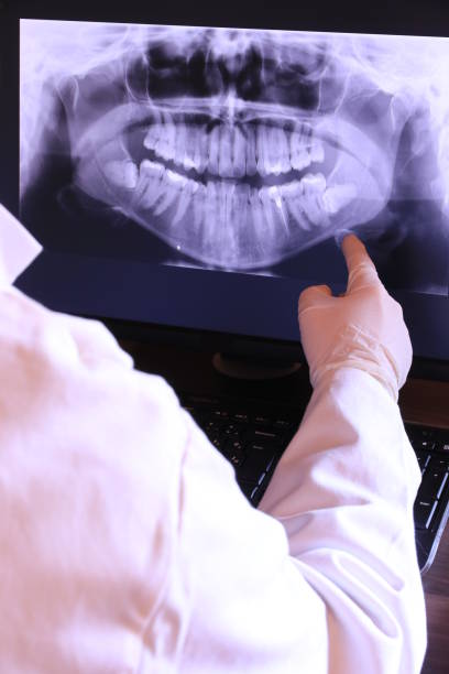 Best Dentist for Tooth Abscess  in Fairwood, MD